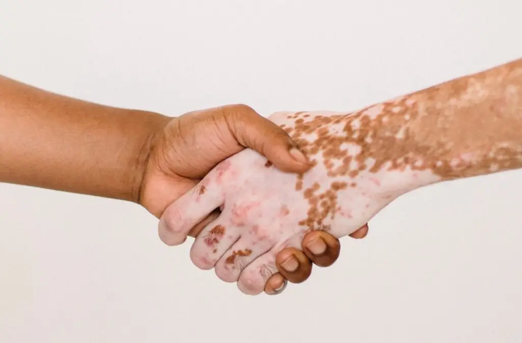 Dermatology of Seattle patient care