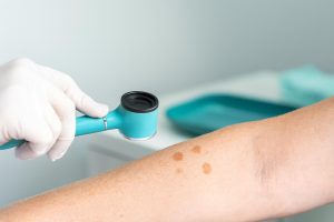 Is Your Acne Connected to Your Gut? New Research Says It Might Be